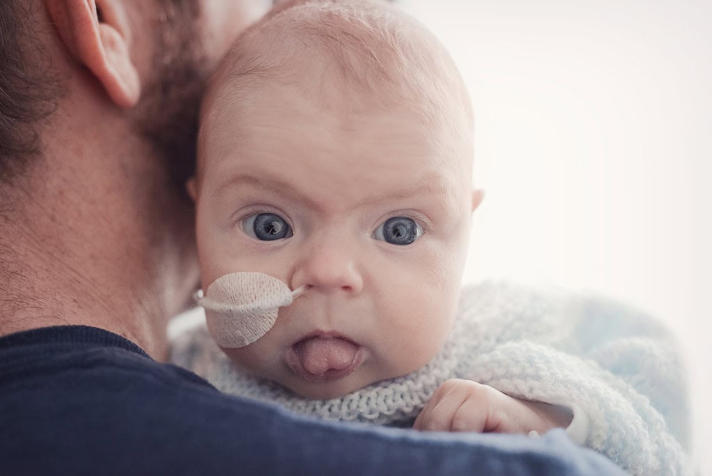 awake baby with feeding tube resting on fathers shoulder